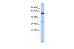 ZDHHC24 Antibody in Western Blot (WB)