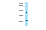 WISP2 Polyclonal Antibody