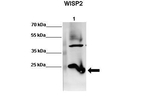 WISP2 Antibody in Western Blot (WB)
