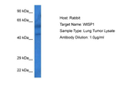 WISP1 Polyclonal Antibody