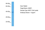 WISP1 Polyclonal Antibody