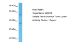 WDR5B Polyclonal Antibody