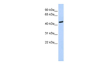 WARS Polyclonal Antibody