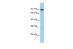UTP14C Antibody in Western Blot (WB)