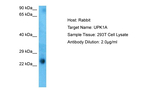 UPK1A Antibody in Western Blot (WB)