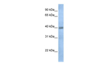 TXNDC15 Polyclonal Antibody
