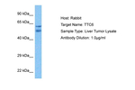 TTC6 Antibody in Western Blot (WB)