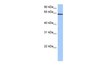 TTC6 Antibody in Western Blot (WB)