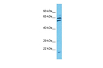 TTC24 Polyclonal Antibody