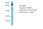 TRMT61B Polyclonal Antibody