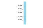 TAFA1 Polyclonal Antibody