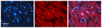ST5 Antibody in Immunohistochemistry (Paraffin) (IHC (P))