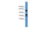 ST5 Antibody in Western Blot (WB)