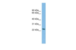 SSX4B Antibody in Western Blot (WB)