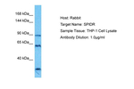 SPIDR Polyclonal Antibody