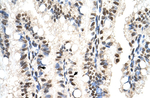 SNX29 Antibody in Immunohistochemistry (IHC)