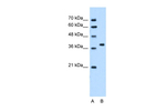 SNX29 Antibody in Western Blot (WB)