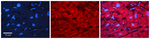 SMC1 Polyclonal Antibody
