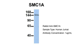 SMC1 Antibody in Western Blot (WB)