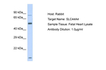SLC44A4 Antibody in Western Blot (WB)