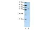 Seryl-tRNA synthetase Polyclonal Antibody