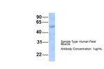 Septin-9 Antibody in Western Blot (WB)