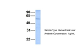 Septin-9 Antibody in Western Blot (WB)