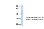 Septin 2 Antibody in Western Blot (WB)