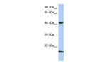 SEC14L4 Polyclonal Antibody