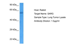 SARG Antibody in Western Blot (WB)