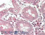RNF213 Polyclonal Antibody
