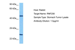 RNF208 Polyclonal Antibody