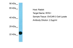 RITA1 Polyclonal Antibody