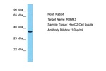 RBM43 Polyclonal Antibody