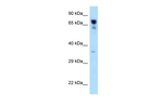 RARS Antibody in Western Blot (WB)