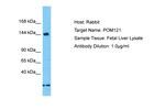 POM121 Antibody in Western Blot (WB)