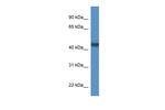 PNMA6A Polyclonal Antibody