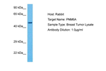 PNMA6A Polyclonal Antibody