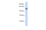 PLA2G4B Antibody in Western Blot (WB)