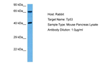 p53 Antibody in Western Blot (WB)