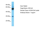 OR10J5 Polyclonal Antibody