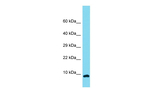 OCC1 Polyclonal Antibody