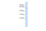 NT5C1B Antibody in Western Blot (WB)