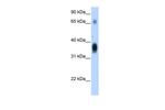 NOV Polyclonal Antibody