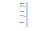 NOV Antibody in Western Blot (WB)
