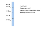 NAT9 Antibody in Western Blot (WB)