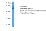 MBTPS2 Polyclonal Antibody