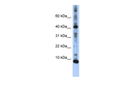 LSM6 Polyclonal Antibody