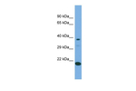 LIPT2 Antibody in Western Blot (WB)