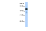 LIPJ Polyclonal Antibody
